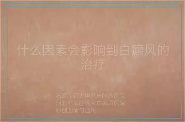 什么因素会影响到白癜风的治疗