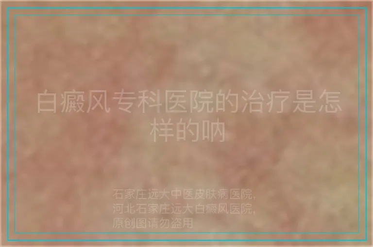白癜风专科医院的治疗是怎样的呐