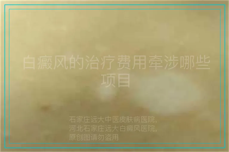 白癜风的治疗费用牵涉哪些项目
