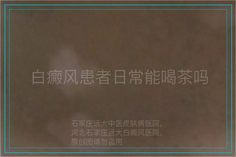 白癜风患者日常能喝茶吗