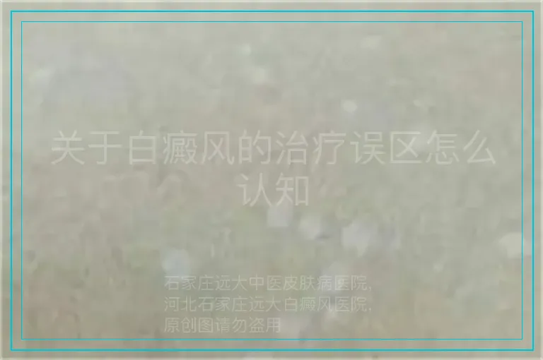 关于白癜风的治疗误区怎么认知
