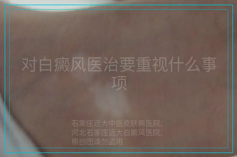 对白癜风医治要重视什么事项