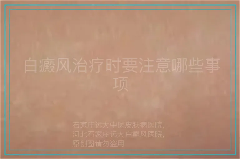 白癜风治疗时要注意哪些事项