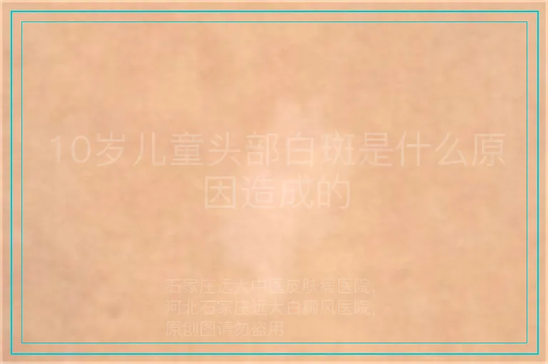 10岁儿童头部白斑是什么原因造成的