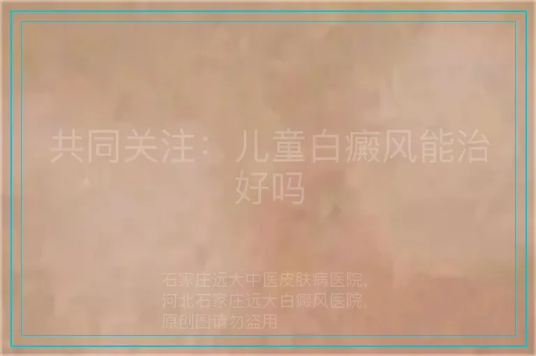 共同关注：儿童白癜风能治好吗