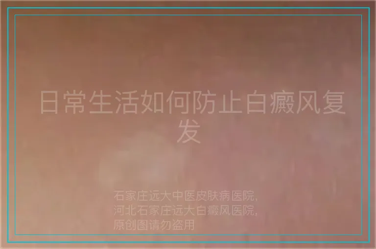 日常生活如何防止白癜风复发