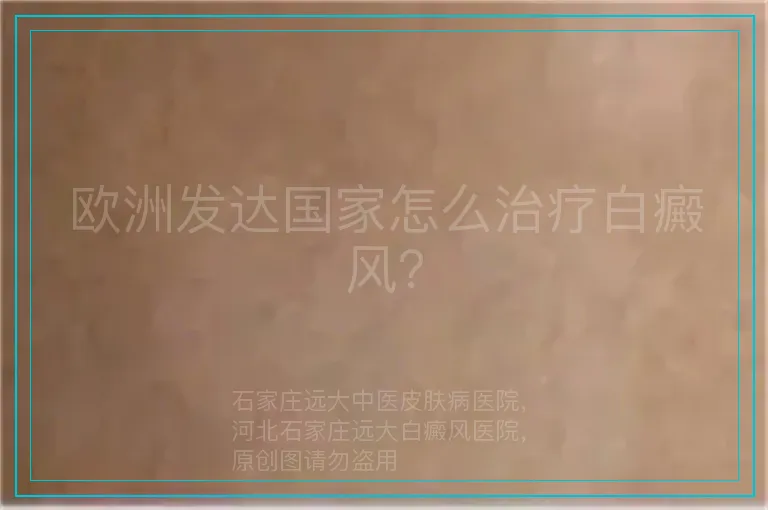 欧洲发达国家怎么治疗白癜风？