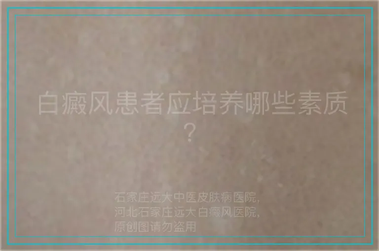 白癜风患者应培养哪些素质？