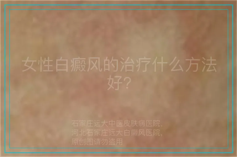女性白癜风的治疗什么方法好?