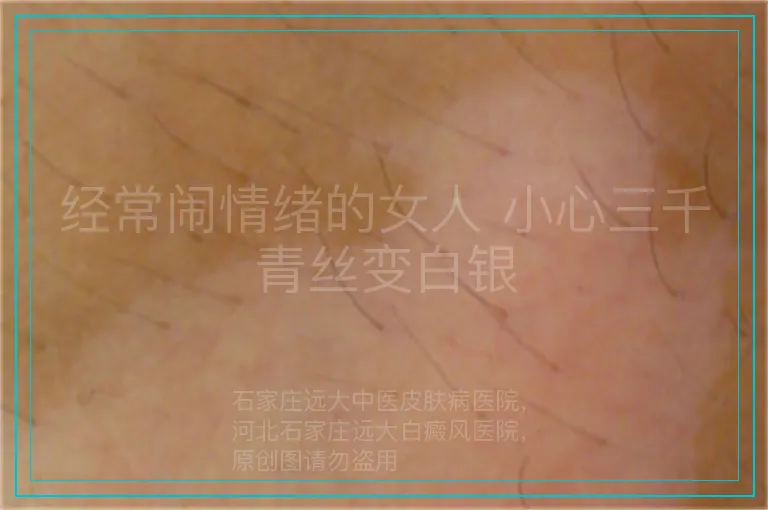 经常闹情绪的女人 小心三千青丝变白银