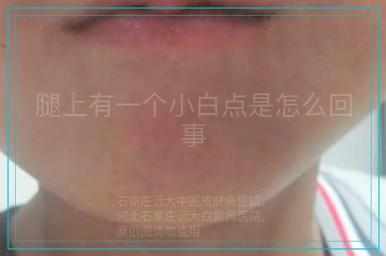 腿上有一个小白点是怎么回事