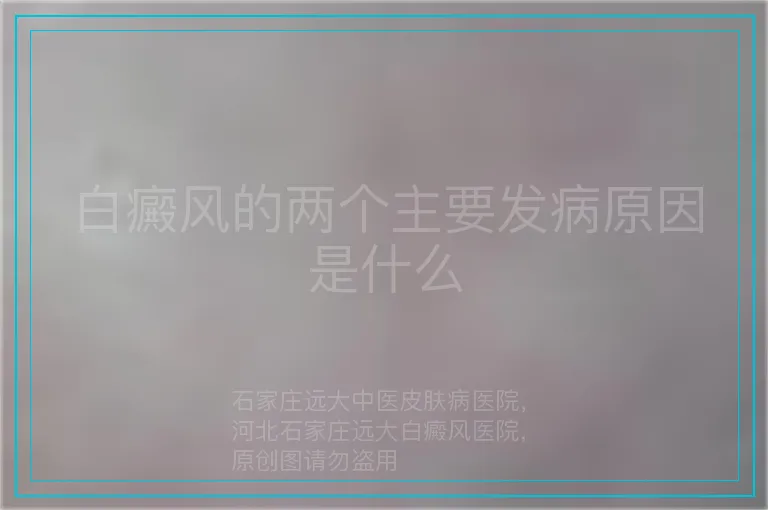 白癜风的两个主要发病原因是什么