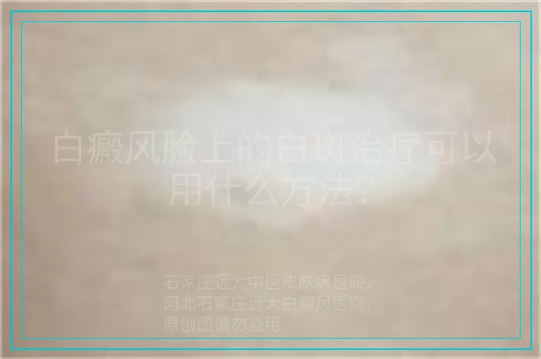 白癜风脸上的白斑治疗可以用什么方法?