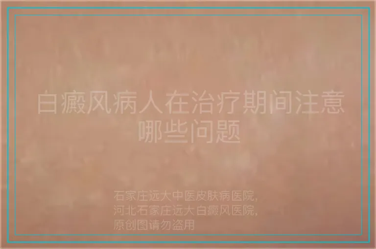 白癜风病人在治疗期间注意哪些问题