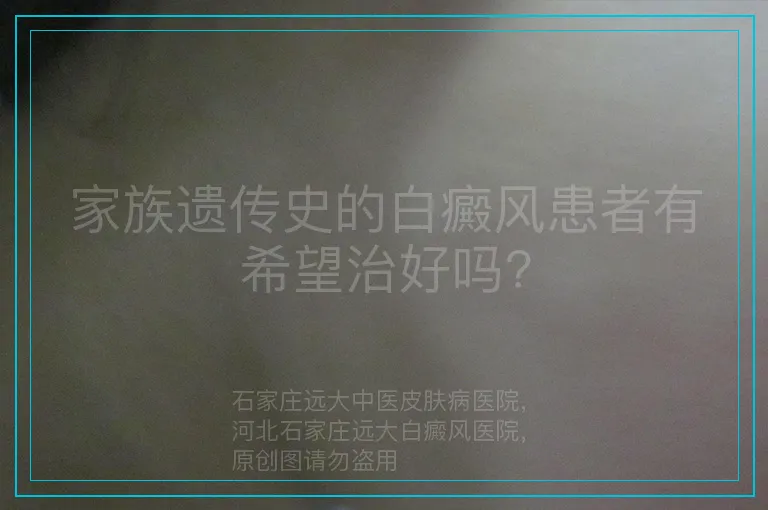 家族遗传史的白癜风患者有希望治好吗?