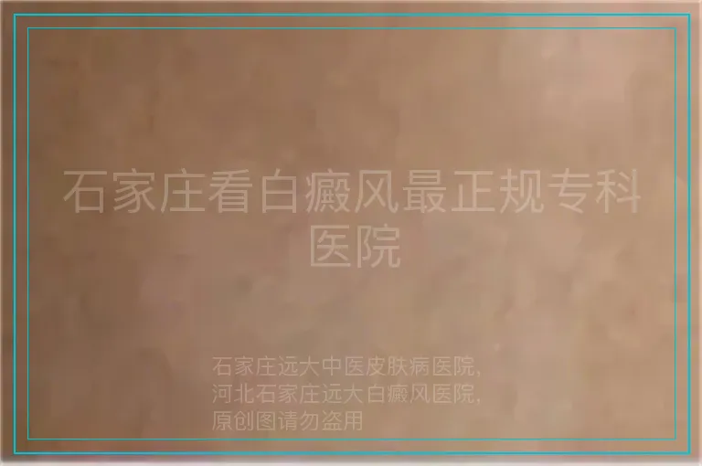 石家庄看白癜风最正规专科医院