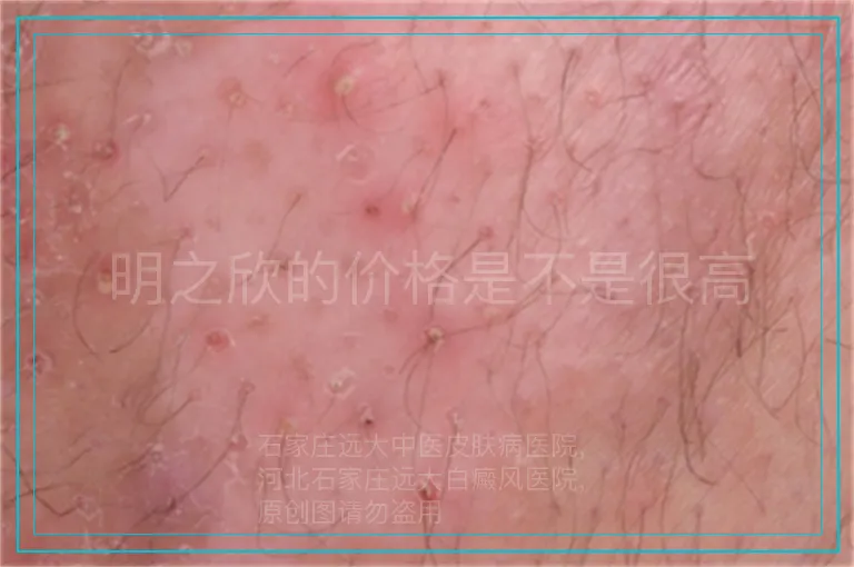 明之欣的价格是不是很高