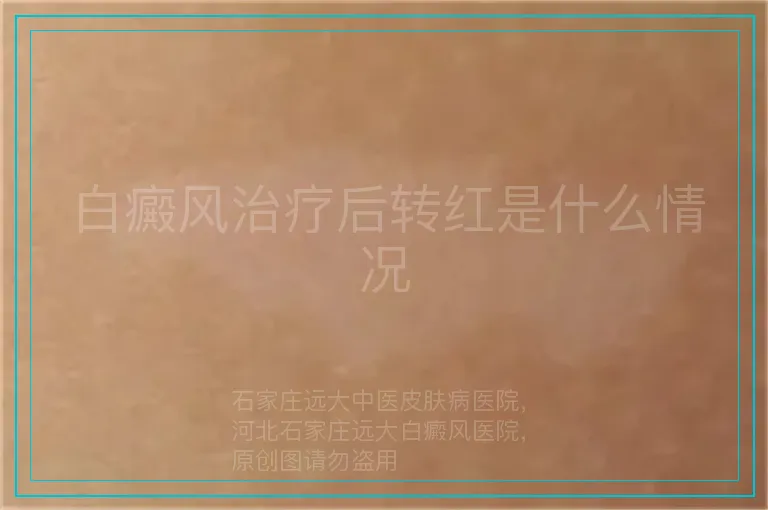 白癜风治疗后转红是什么情况