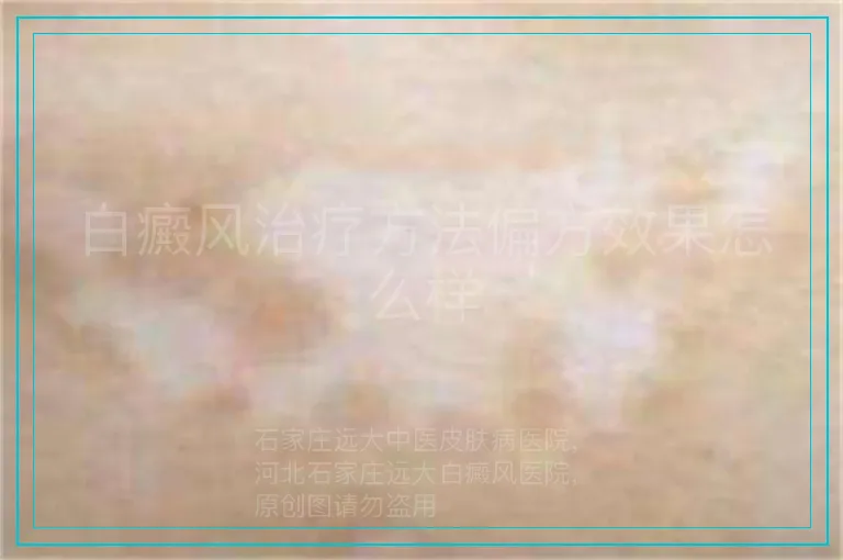 白癜风治疗方法偏方效果怎么样