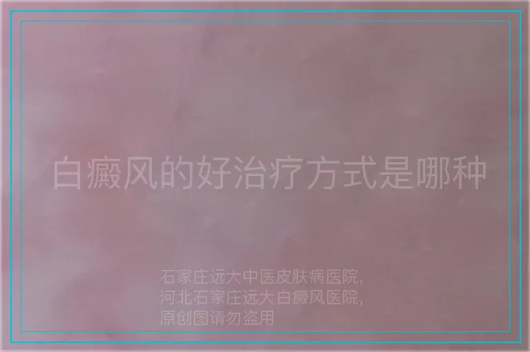白癜风的好治疗方式是哪种