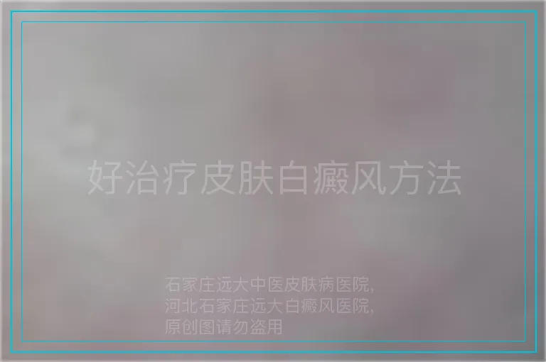 好治疗皮肤白癜风方法