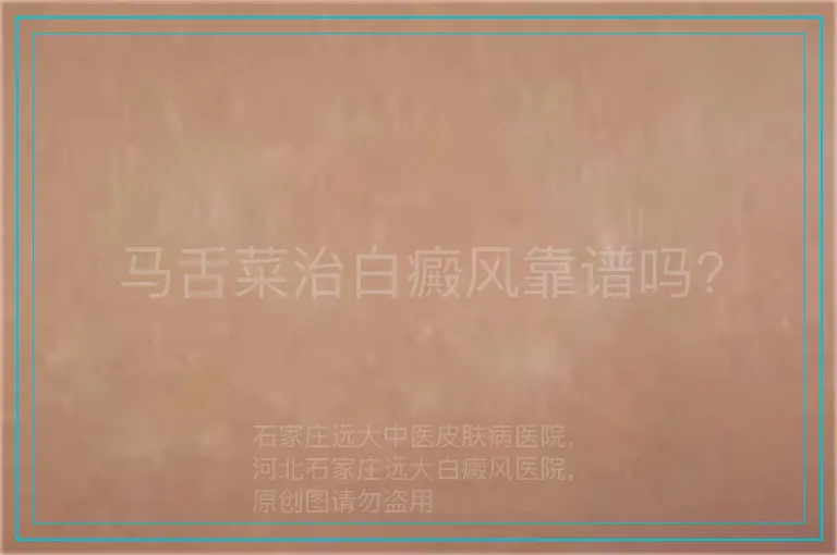马舌菜治白癜风靠谱吗?