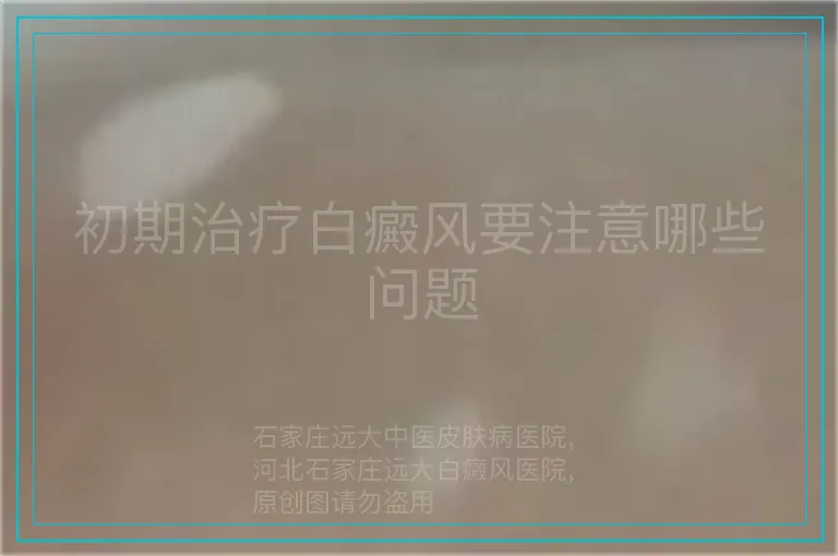 初期治疗白癜风要注意哪些问题