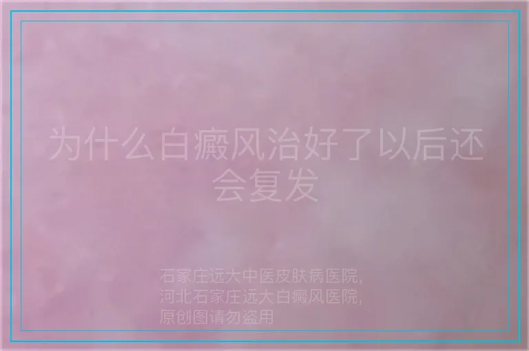 为什么白癜风治好了以后还会复发
