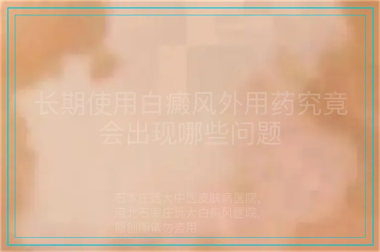 长期使用白癜风外用药究竟会出现哪些问题