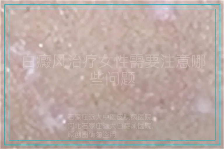白癜风治疗女性需要注意哪些问题