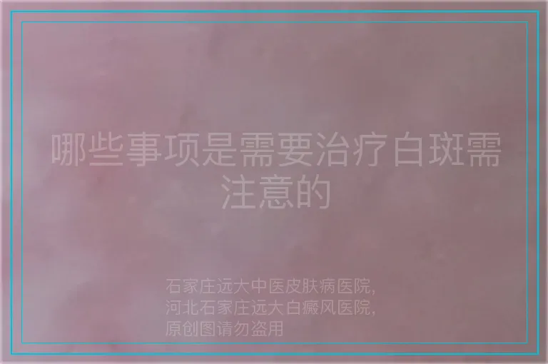 哪些事项是需要治疗白斑需注意的