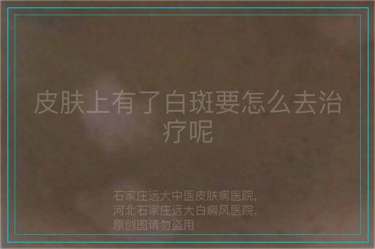 皮肤上有了白斑要怎么去治疗呢