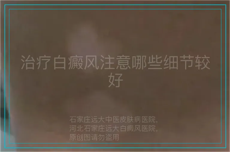 治疗白癜风注意哪些细节较好