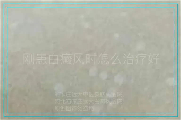刚患白癜风时怎么治疗好