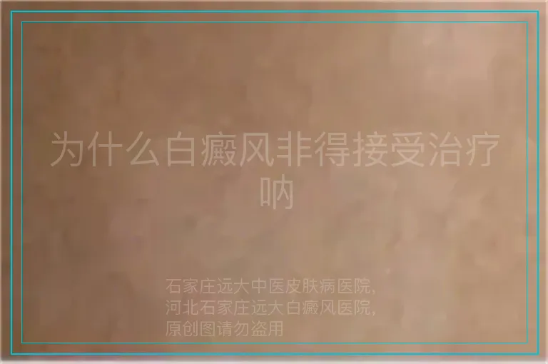 为什么白癜风非得接受治疗呐