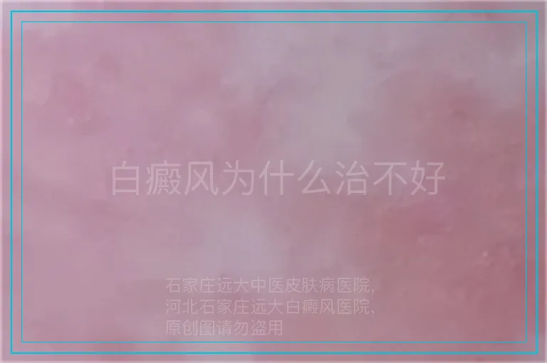 白癜风为什么治不好