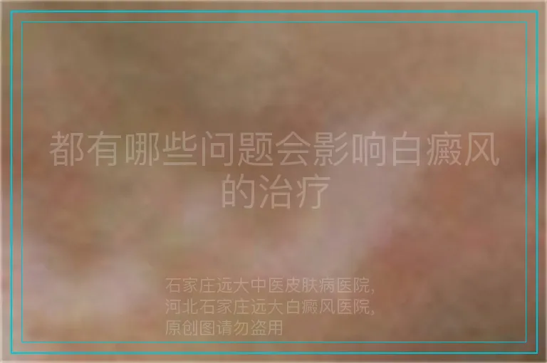 都有哪些问题会影响白癜风的治疗
