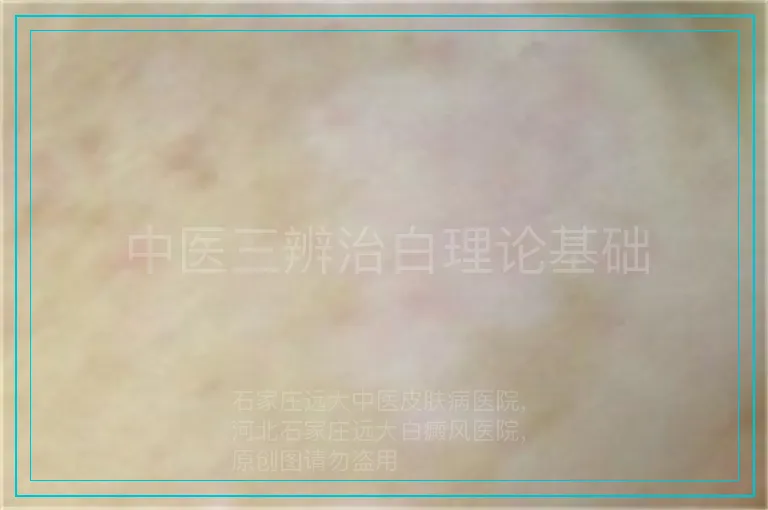 中医三辨治白理论基础