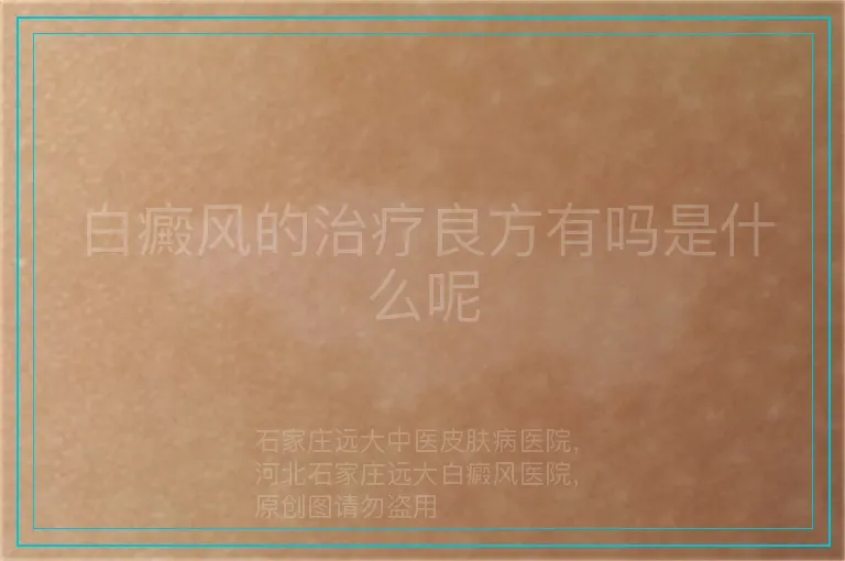 白癜风的治疗良方有吗是什么呢