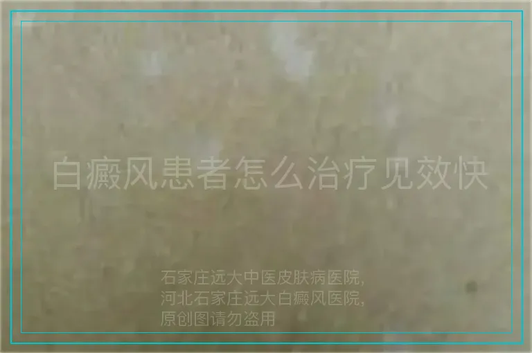 白癜风患者怎么治疗见效快