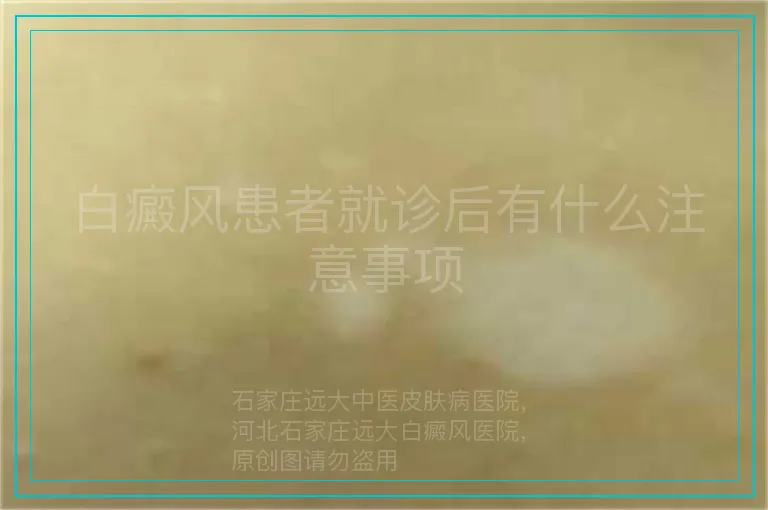 白癜风患者就诊后有什么注意事项