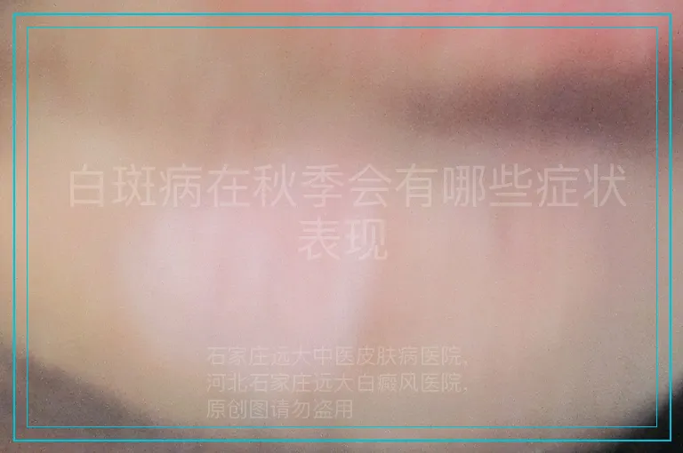 白斑病在秋季会有哪些症状表现