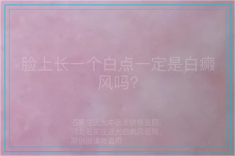 脸上长一个白点一定是白癜风吗?
