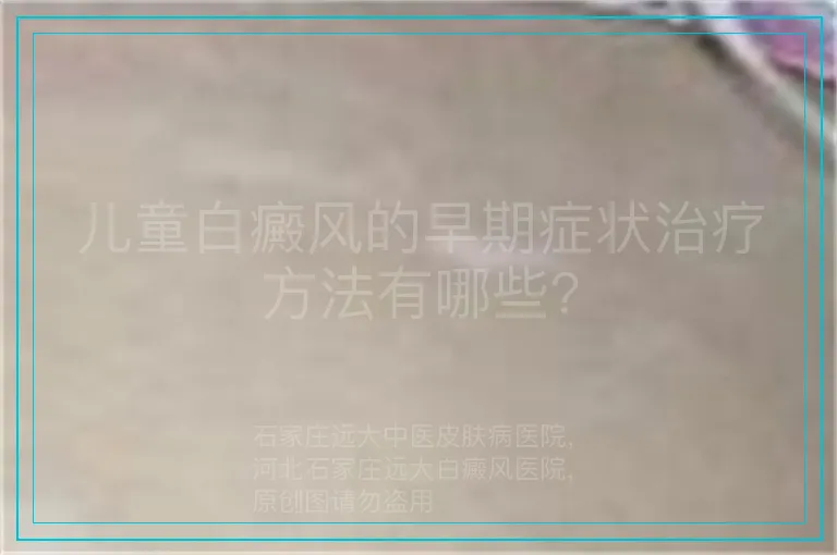 儿童白癜风的早期症状治疗方法有哪些?