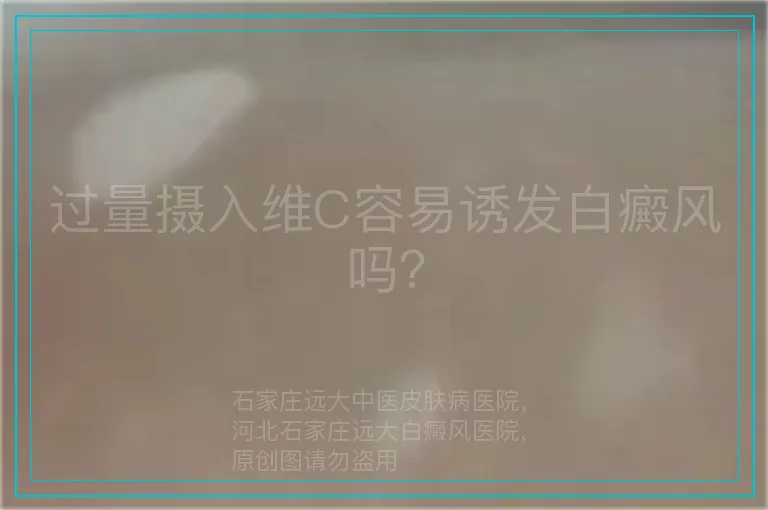 过量摄入维C容易诱发白癜风吗？