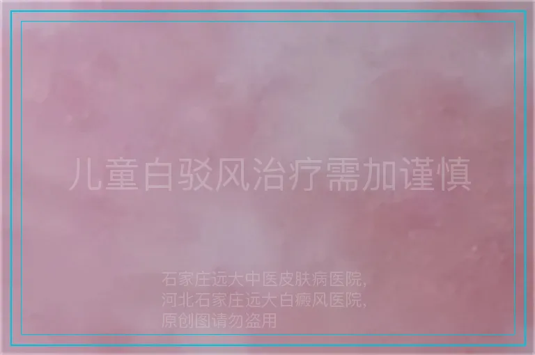 儿童白驳风治疗需加谨慎