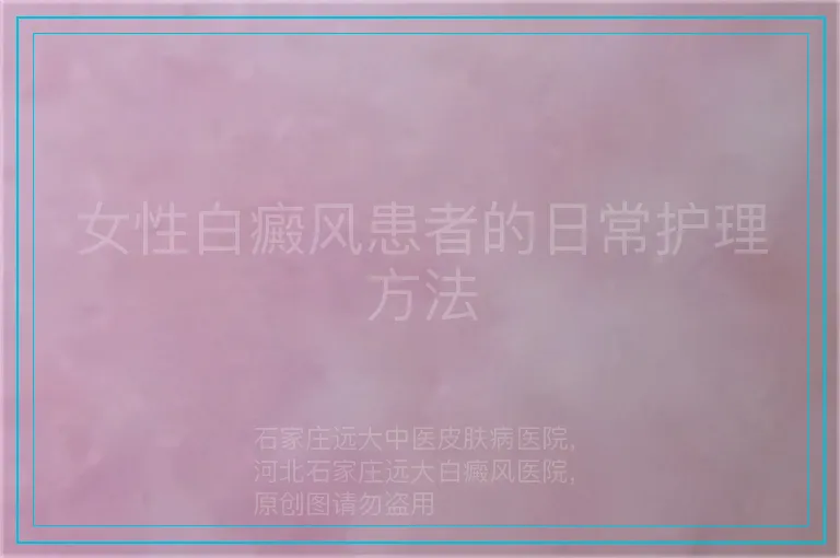 女性白癜风患者的日常护理方法