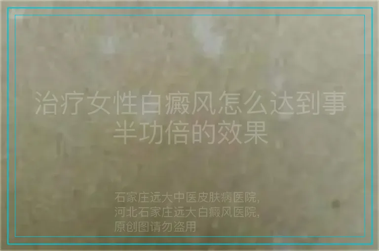 治疗女性白癜风怎么达到事半功倍的效果
