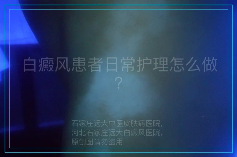 白癜风患者日常护理怎么做？