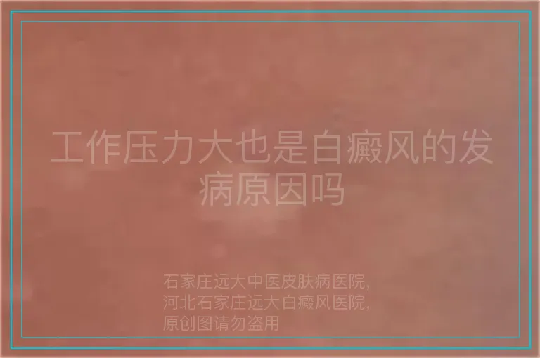 工作压力大也是白癜风的发病原因吗